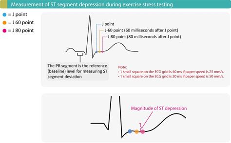 sudden blood pressure drop after stress test|stress testing questions and answers.